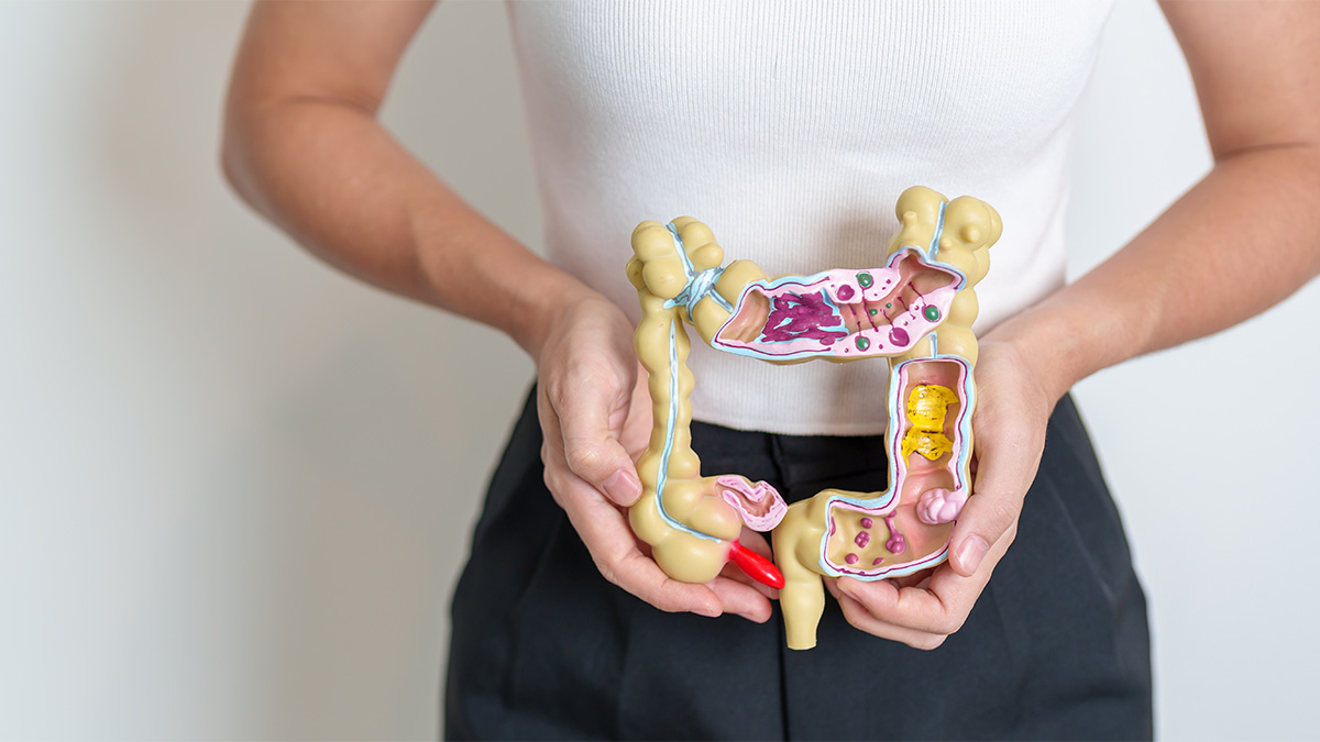 Bild Frau hält Modell von Magen